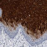 CRNN Antibody in Immunohistochemistry (IHC)