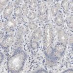 CRNN Antibody in Immunohistochemistry (IHC)