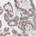 SMARCC1 Antibody in Immunohistochemistry (Paraffin) (IHC (P))