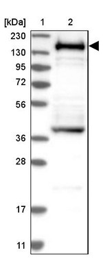 SMARCC1 Antibody in Western Blot (WB)