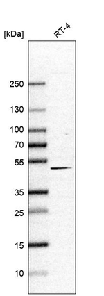 Lass3 Antibody in Western Blot (WB)