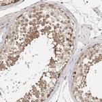 Lass3 Polyclonal Antibody