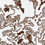 TRIM56 Antibody in Immunohistochemistry (Paraffin) (IHC (P))