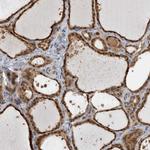 USH1G Antibody in Immunohistochemistry (Paraffin) (IHC (P))