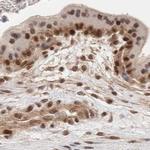 GATAD2A Antibody in Immunohistochemistry (IHC)