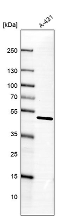 ADSS Antibody in Western Blot (WB)