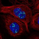 LURAP1L Polyclonal Antibody