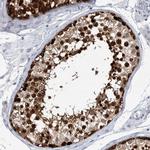 LURAP1L Antibody in Immunohistochemistry (Paraffin) (IHC (P))