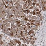 SMAP2 Polyclonal Antibody