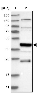 SMAP2 Antibody in Western Blot (WB)