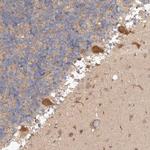 C17orf53 Polyclonal Antibody