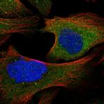 TAX1BP1 Polyclonal Antibody