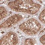 TAX1BP1 Antibody in Immunohistochemistry (IHC)