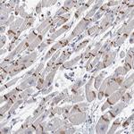 TMEM102 Polyclonal Antibody