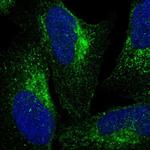VPS53 Polyclonal Antibody