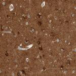 VPS53 Antibody in Immunohistochemistry (IHC)