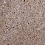 VPS53 Antibody in Immunohistochemistry (IHC)