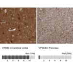 VPS53 Antibody