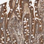 VPS53 Antibody in Immunohistochemistry (IHC)