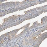 SLFN12L Antibody in Immunohistochemistry (Paraffin) (IHC (P))