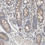 SLFN12L Polyclonal Antibody