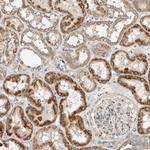 SLFN12L Antibody in Immunohistochemistry (Paraffin) (IHC (P))