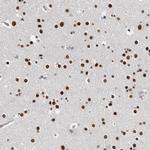 ZBTB49 Antibody in Immunohistochemistry (Paraffin) (IHC (P))