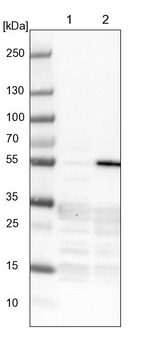 ZBTB49 Antibody in Western Blot (WB)