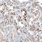 C1orf112 Antibody in Immunohistochemistry (Paraffin) (IHC (P))