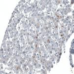 C1orf112 Antibody in Immunohistochemistry (Paraffin) (IHC (P))