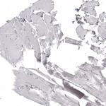 C1orf112 Antibody in Immunohistochemistry (Paraffin) (IHC (P))