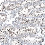 C1orf112 Antibody in Immunohistochemistry (Paraffin) (IHC (P))