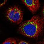 C1orf112 Polyclonal Antibody