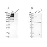 C1orf112 Antibody in Western Blot (WB)