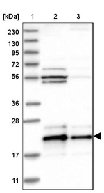 C17orf49 Antibody in Western Blot (WB)