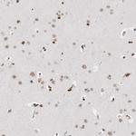 C17orf49 Antibody in Immunohistochemistry (IHC)