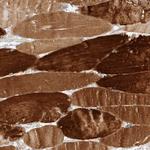 KBTBD5 Polyclonal Antibody