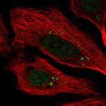 CEP112 Polyclonal Antibody