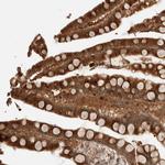 OTUD6B Antibody in Immunohistochemistry (Paraffin) (IHC (P))