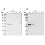 OTUD6B Antibody in Western Blot (WB)