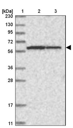 NR1 Antibody in Western Blot (WB)