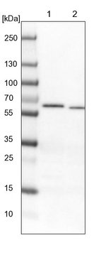 NR1 Antibody in Western Blot (WB)