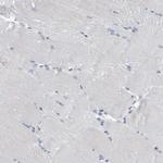 FAM83H Antibody in Immunohistochemistry (Paraffin) (IHC (P))