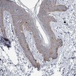 FAM83H Antibody in Immunohistochemistry (IHC)