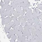 FAM83H Antibody in Immunohistochemistry (IHC)