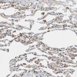 KLHL6 Antibody in Immunohistochemistry (Paraffin) (IHC (P))