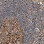 KLHL6 Polyclonal Antibody