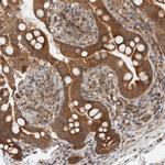 KLHL6 Antibody in Immunohistochemistry (Paraffin) (IHC (P))