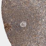 KLHL6 Antibody in Immunohistochemistry (Paraffin) (IHC (P))