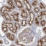 ANKFY1 Polyclonal Antibody